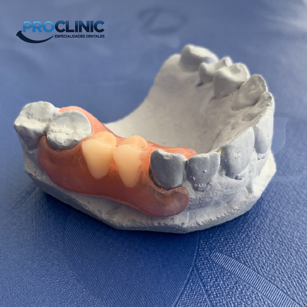 Endipante Marketing - Proclinic dental - Portafolio 4